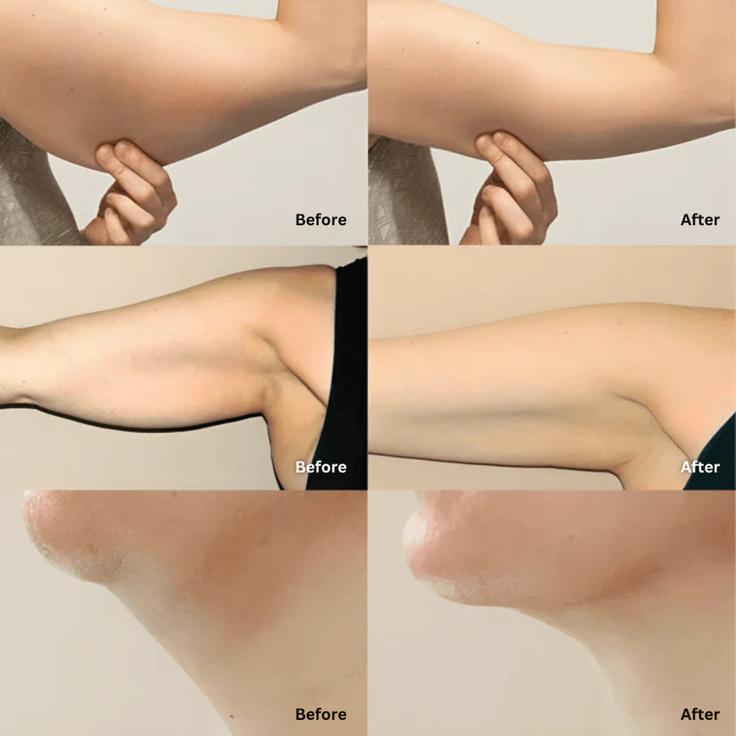 Organic Lymphatic Support Herbal Blend