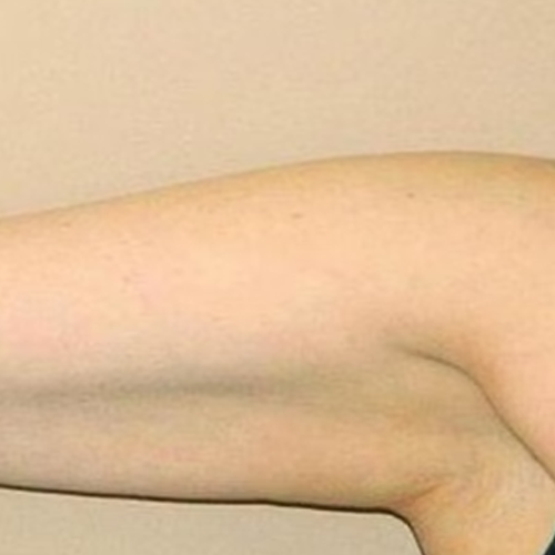 Fosters Organic Lymphatic Support Herbal Blend