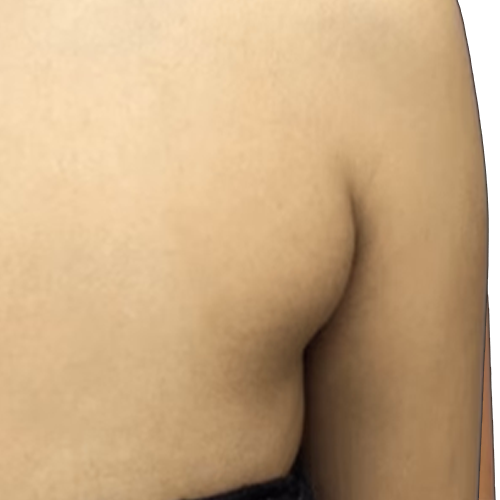 Fosters Organic Lymphatic Support Herbal Blend